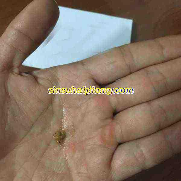 b2 1 600x600 1 - sìn sú Hải Phòng