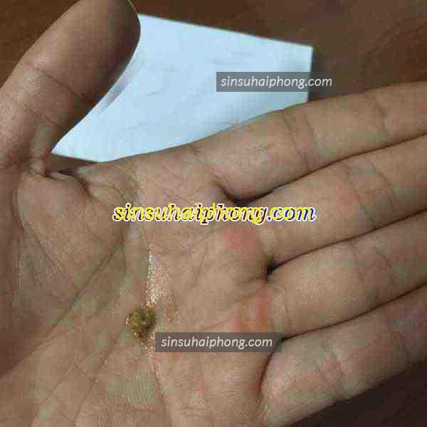 b2 1 600x600 1 - sìn sú Hải Phòng